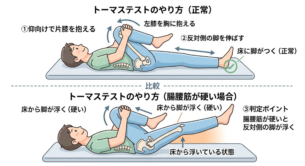 腸腰筋の硬さを確認するトーマステストの実演
